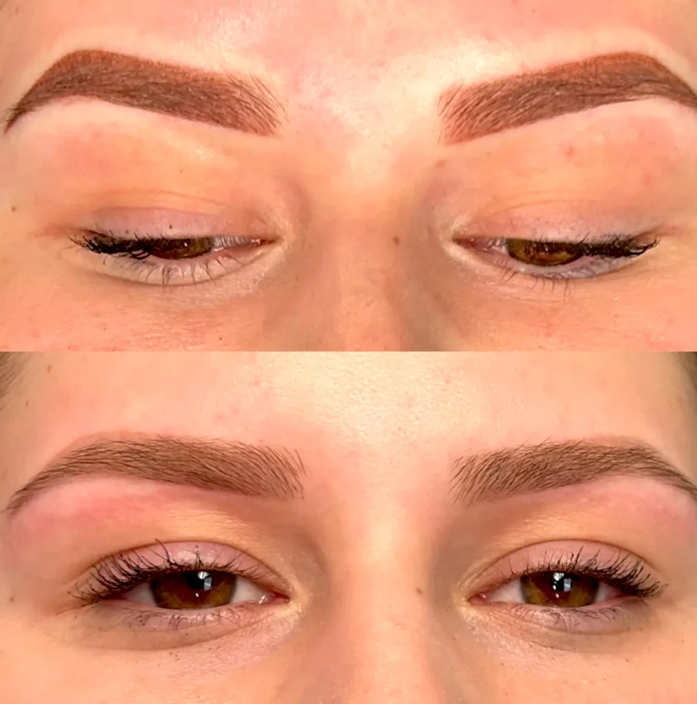 cosmetic tattooing