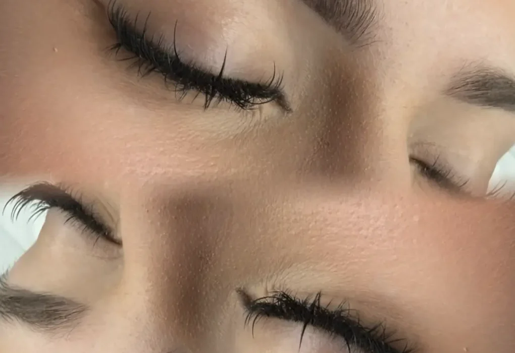 cosmetic tattoo removal course